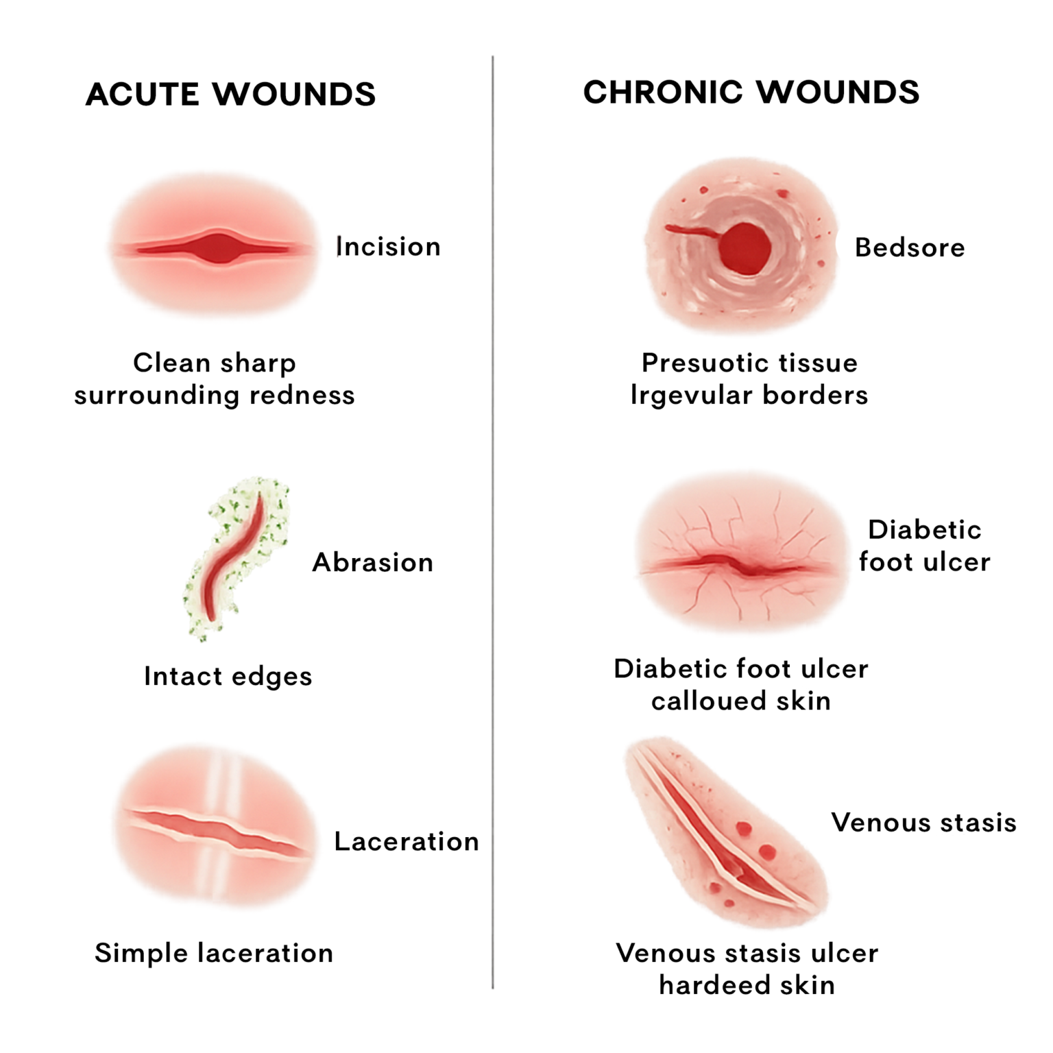 Wound Risks Acute vs. Chronic Wounds: Key Differences & Healing Guide | EON Cure
