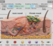 Acute vs chronic wounds, Wound healing process, Diabetic ulcer management, Chronic wound infection, Types of skin injuries
